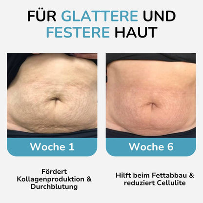 Flenura Luxe™ Rotlicht Gürtel